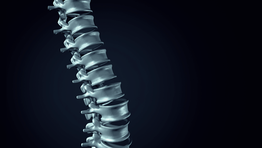 Spinal Injections for Back Pain Management